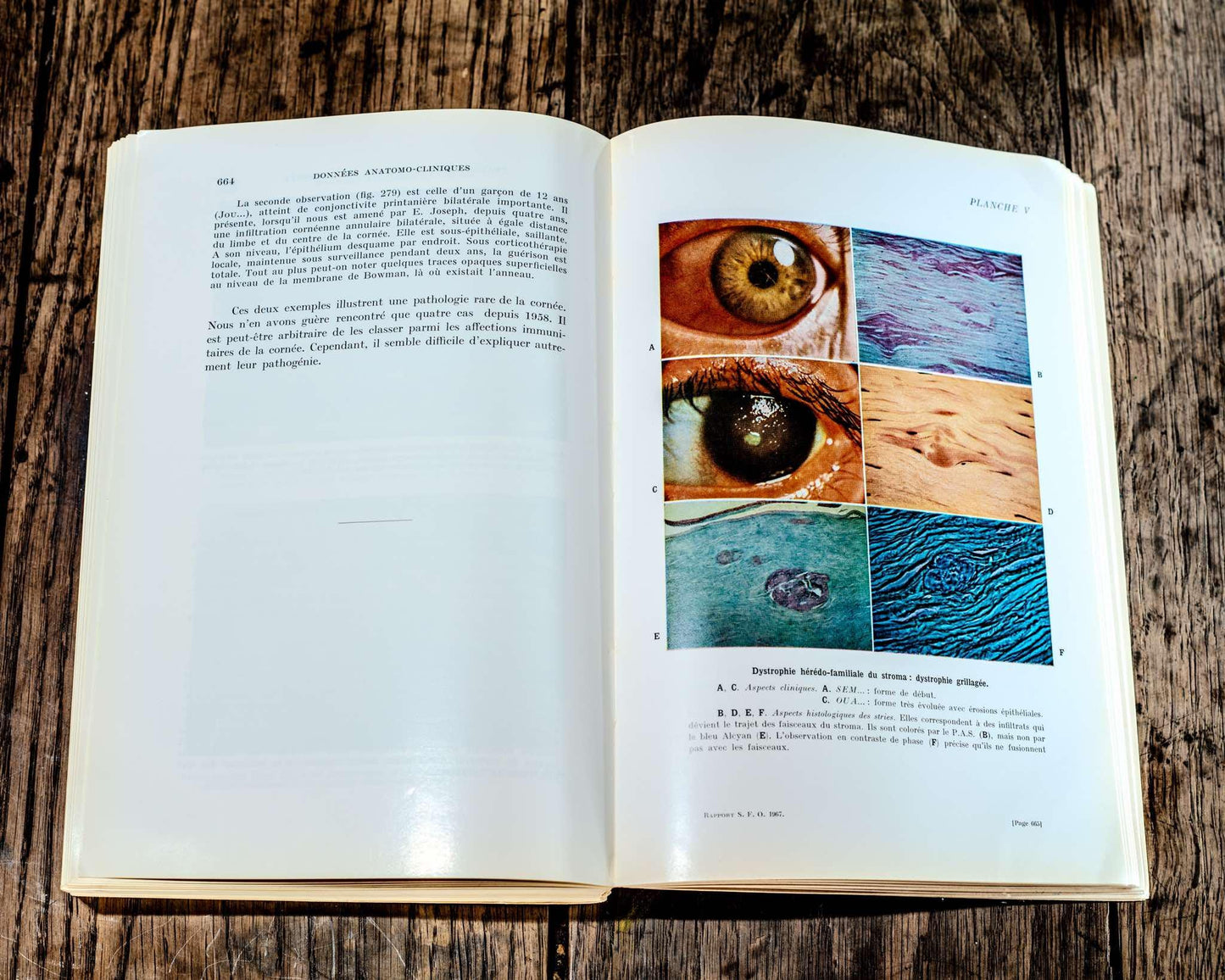 The set of 13 medical books, ophtalmology 1964-1973, Masson et cie, èditeurs 120, Medicine, Textbook for Doctors and Students Study Book